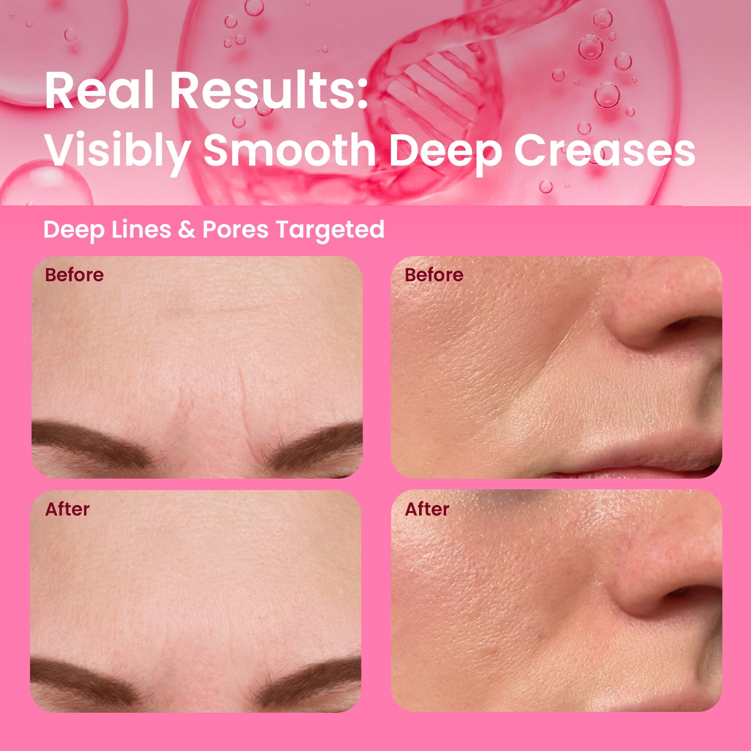 PDRN Wrinkle Patches 60 Ct | Overnight Anti Aging Wrinkle Patch for Face